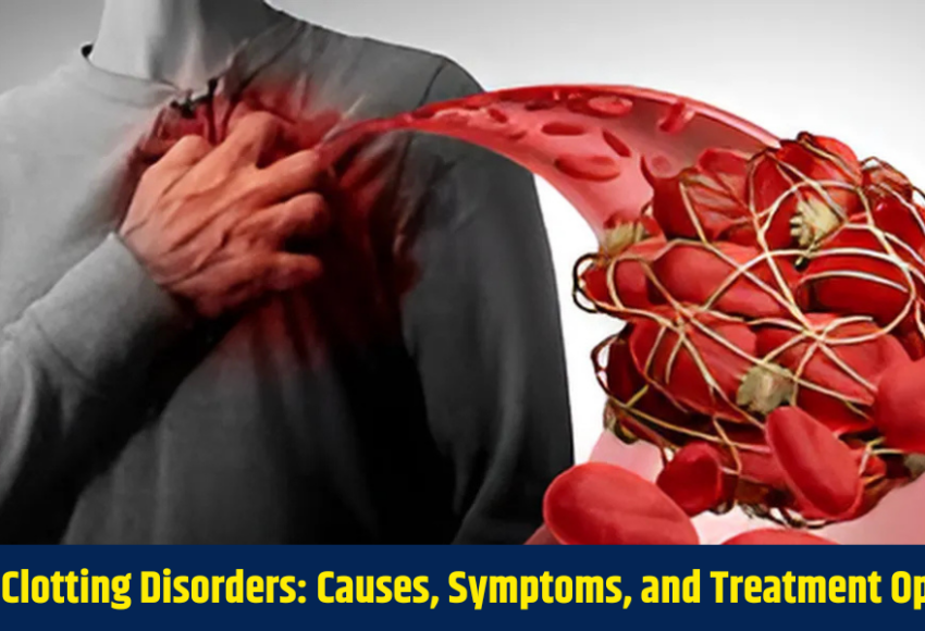 Blood Clotting Disorders: Causes, Symptoms, and Treatment Options.