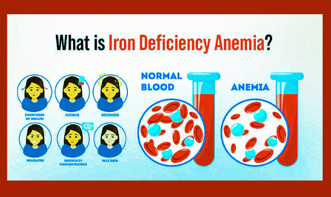 Anemia- causes,symptoms