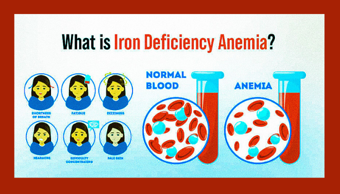 Anemia- causes,symptoms