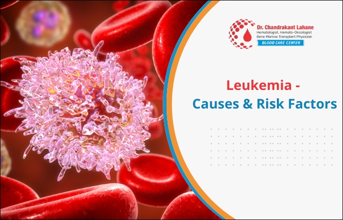 Leukemia - Causes & Risk Factors
