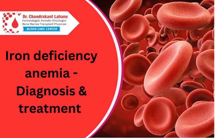Iron Deficiency Anemia: Diagnosis & Treatment
