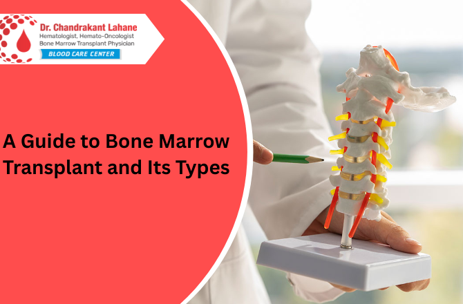 A Guide to Bone Marrow Transplant and Its Types | Dr. Chandrakant Lahane Pune