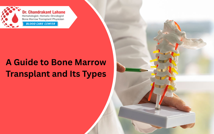 A Guide to Bone Marrow Transplant and Its Types | Dr. Chandrakant Lahane Pune