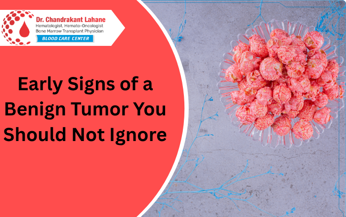 Early Signs of Benign Tumor