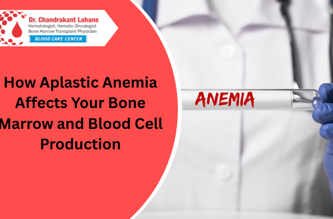 aplastic anemia