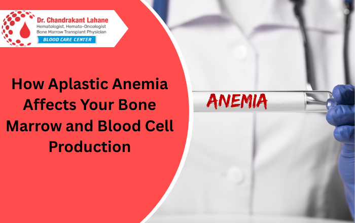 aplastic anemia