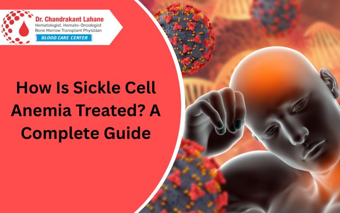 How Is Sickle Cell Anemia Treated